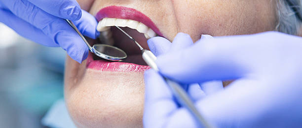 Best Emergency Tooth Extraction in Charleston, SC
