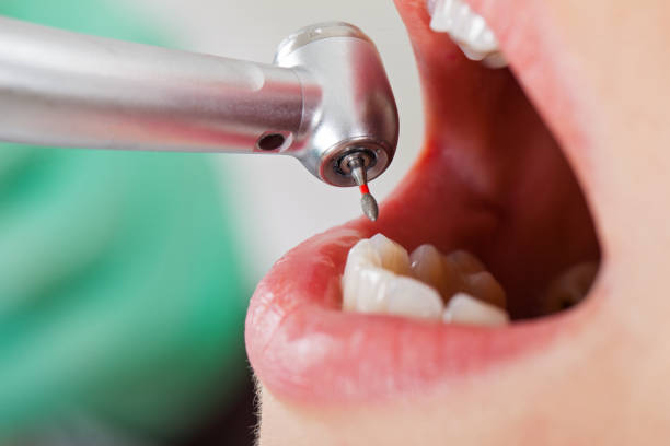 Best Pediatric Emergency Dentist in Charleston, SC